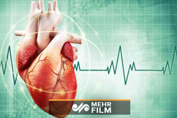 درمان مطمئن اختلال ریتمی قلبی در ایران