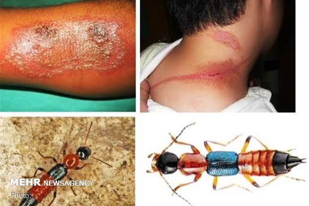 حمله دراکولا به اندیکا/ پادروس حشره‌ای با نقاب مورچه