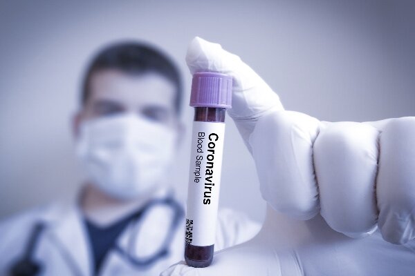 عامل کشندگی ویروس کرونا/شایع ترین علائم کووید ۱۹